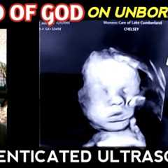 Mother prays repeatedly to God for her unborn child: Lord, please keep Your Hand on my baby!